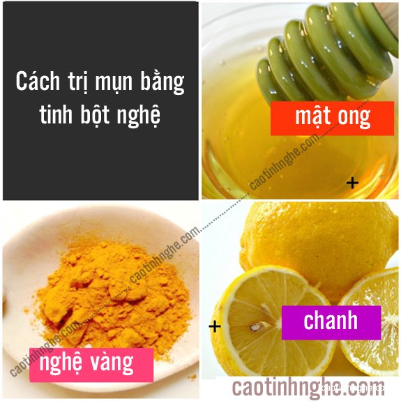Trị mụn bằng tinh bột nghệ Trị mụn bằng tinh bột nghệ